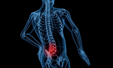 As razóns para o desenvolvemento da osteocondrose lumbar