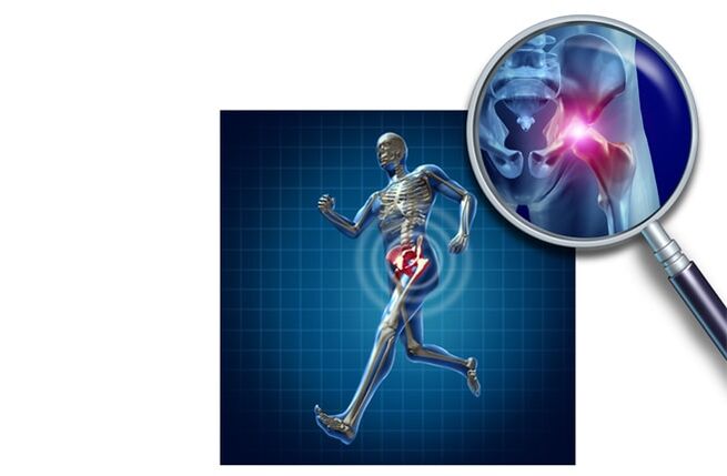 Dor ao correr na articulación da cadeira